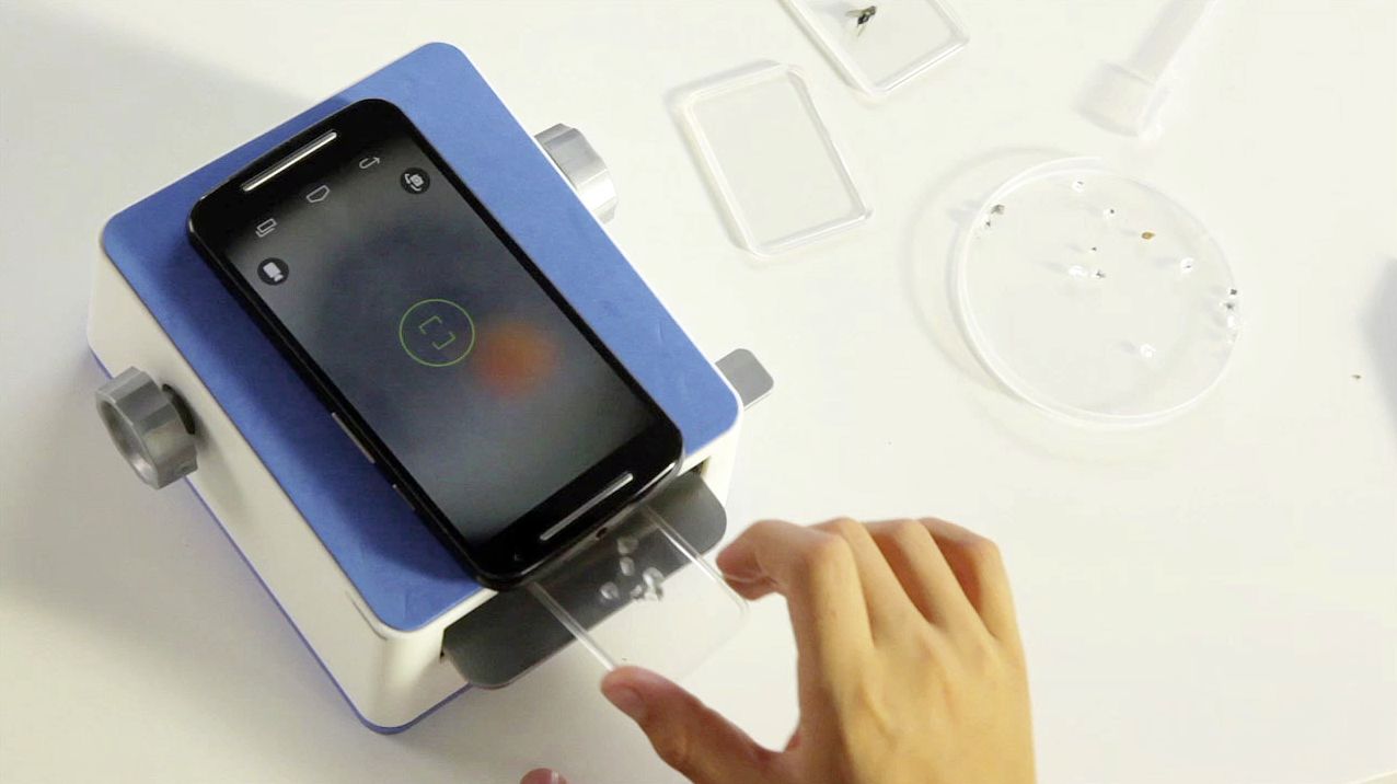 Smartscope