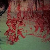 Blood Loss