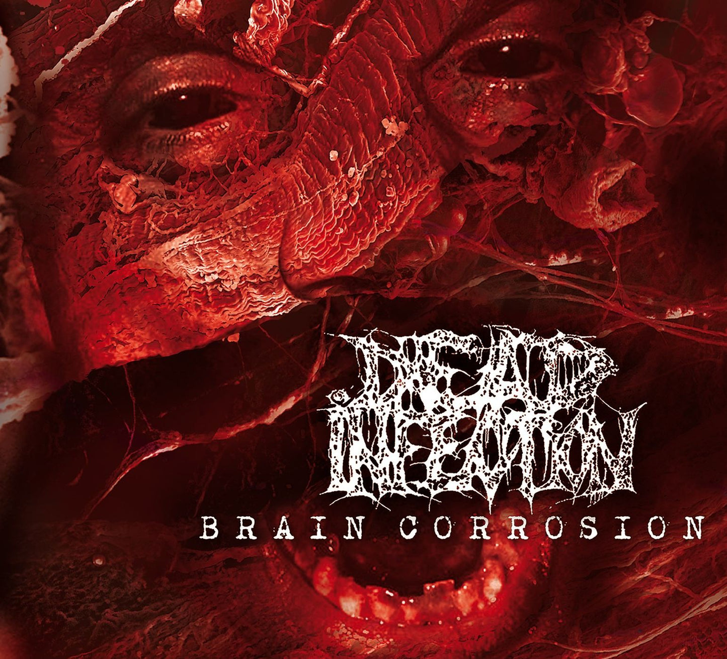 Brain Corrosion