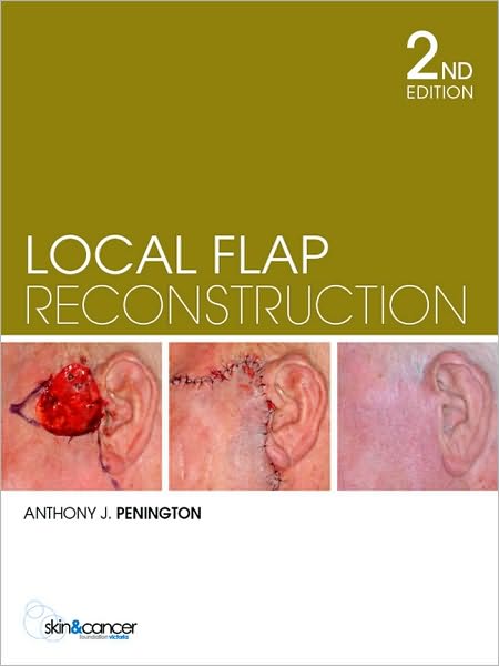 Local Flap Reconstruction