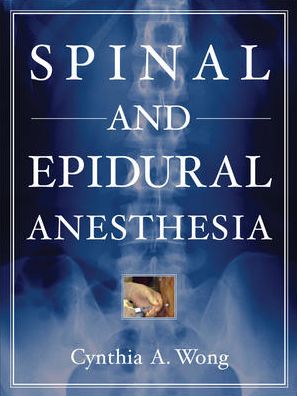 Spinal and Epidural Anesthesia