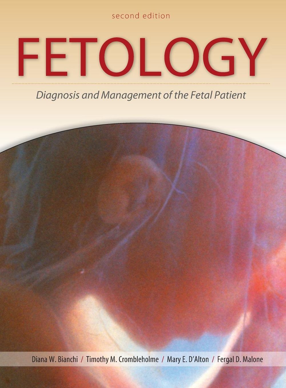 Fetology: Diagnosis and Management of the Fetal Patient, Second Edition