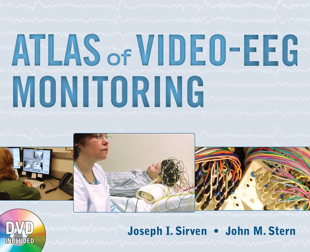 Atlas of Video-EEG Monitoring