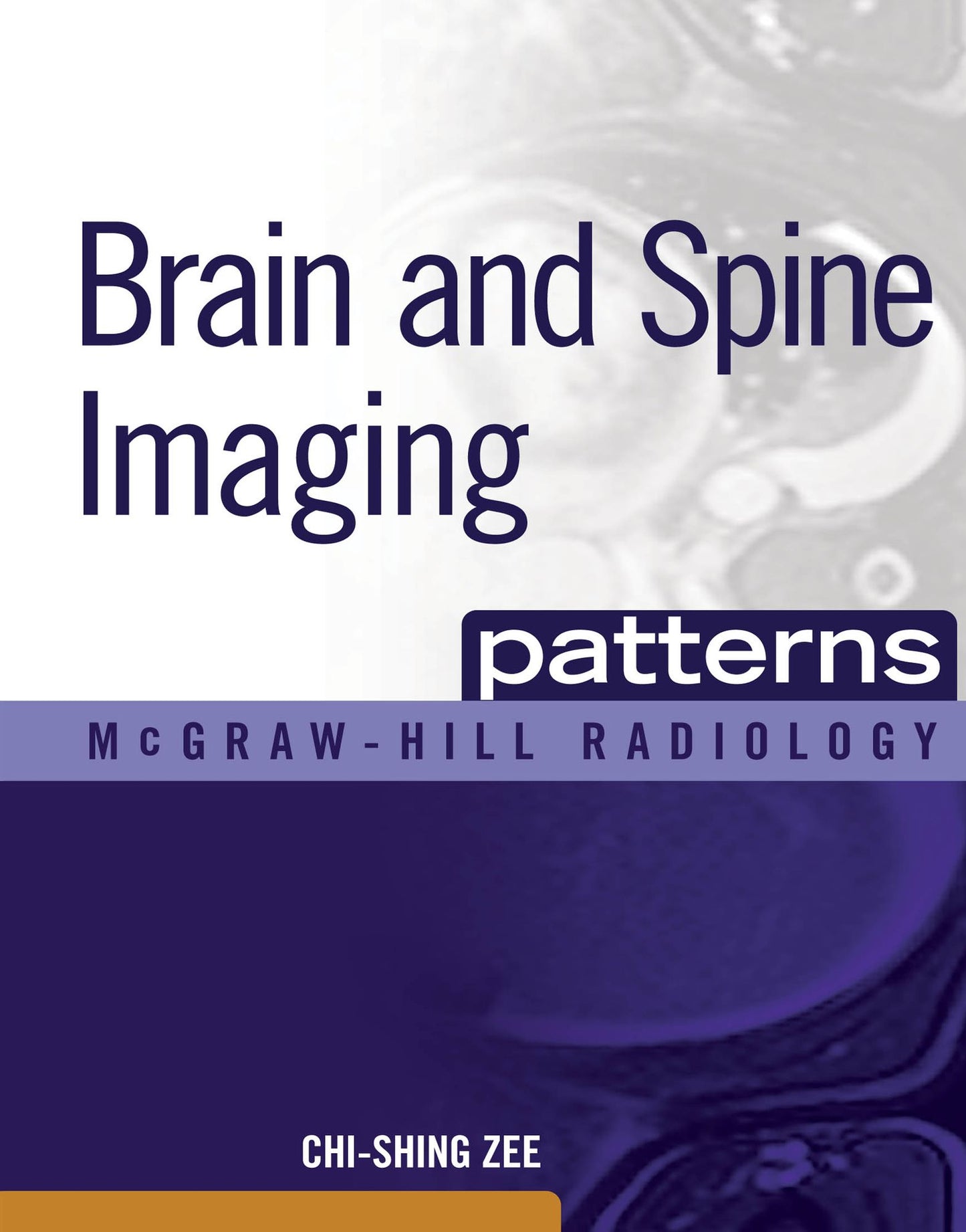 Brain and Spine Imaging Patterns: BRAIN & SPINE IMAGING (EBOOK)