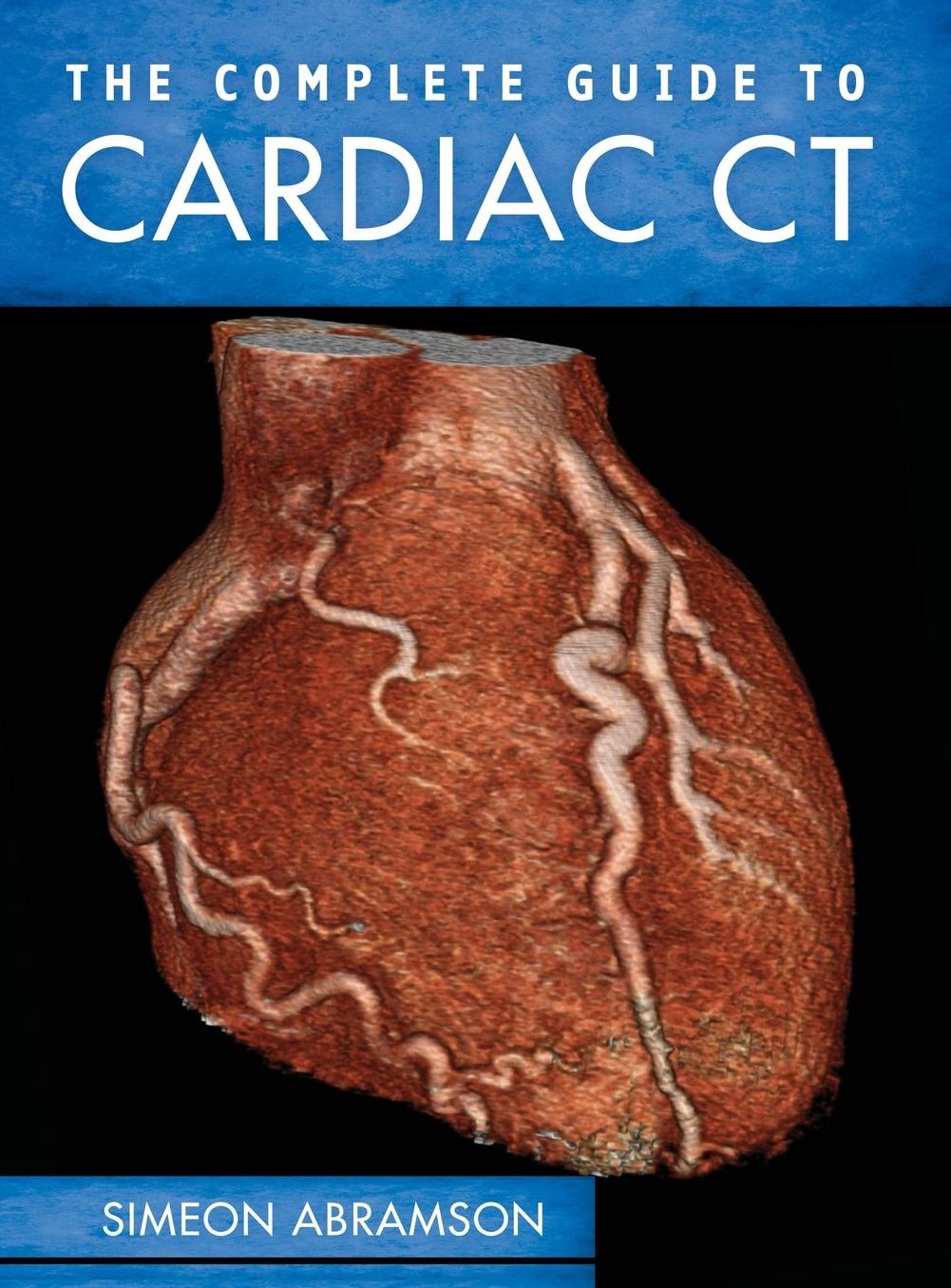 The Complete Guide to Cardiac CT