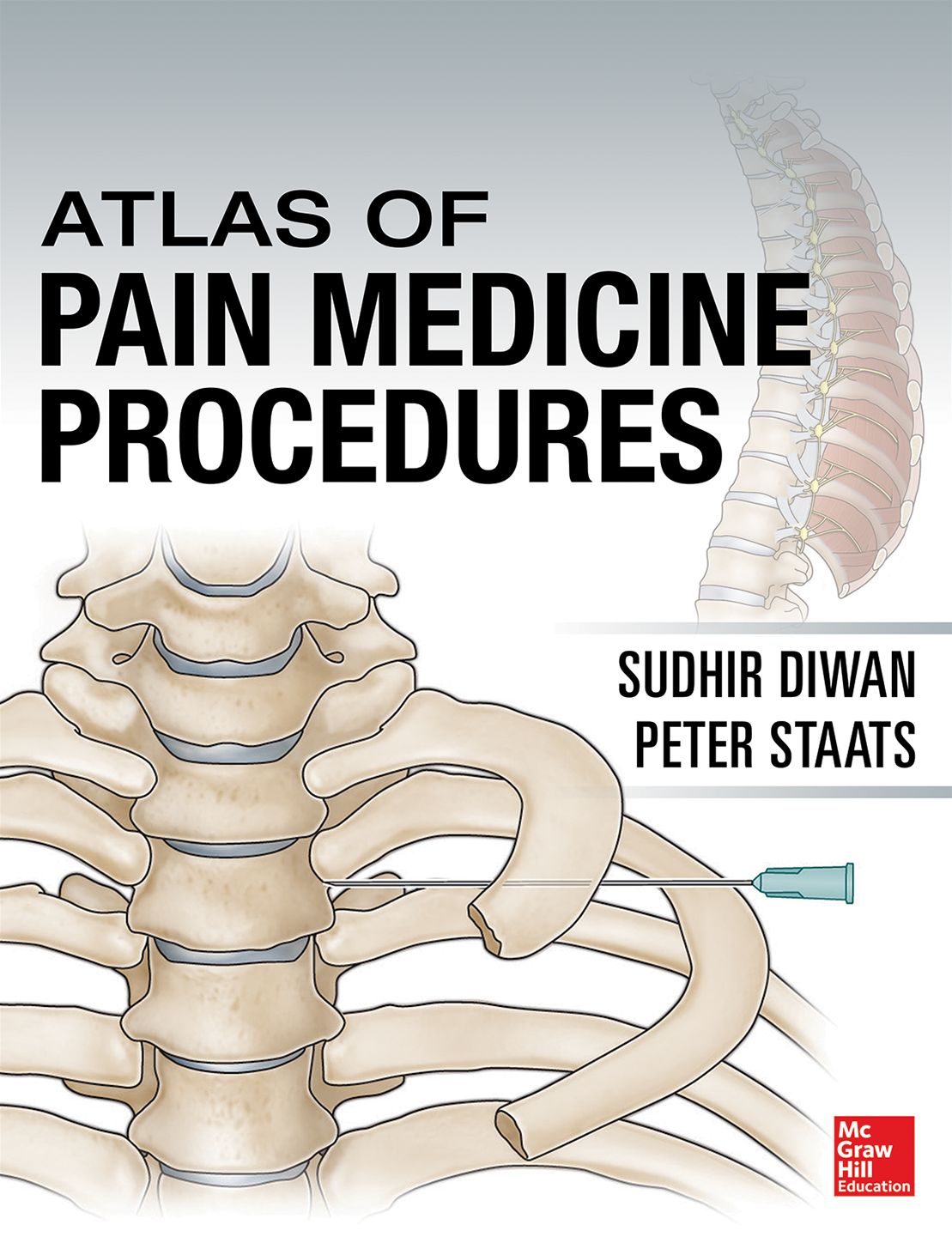 Atlas of Pain Medicine Procedures