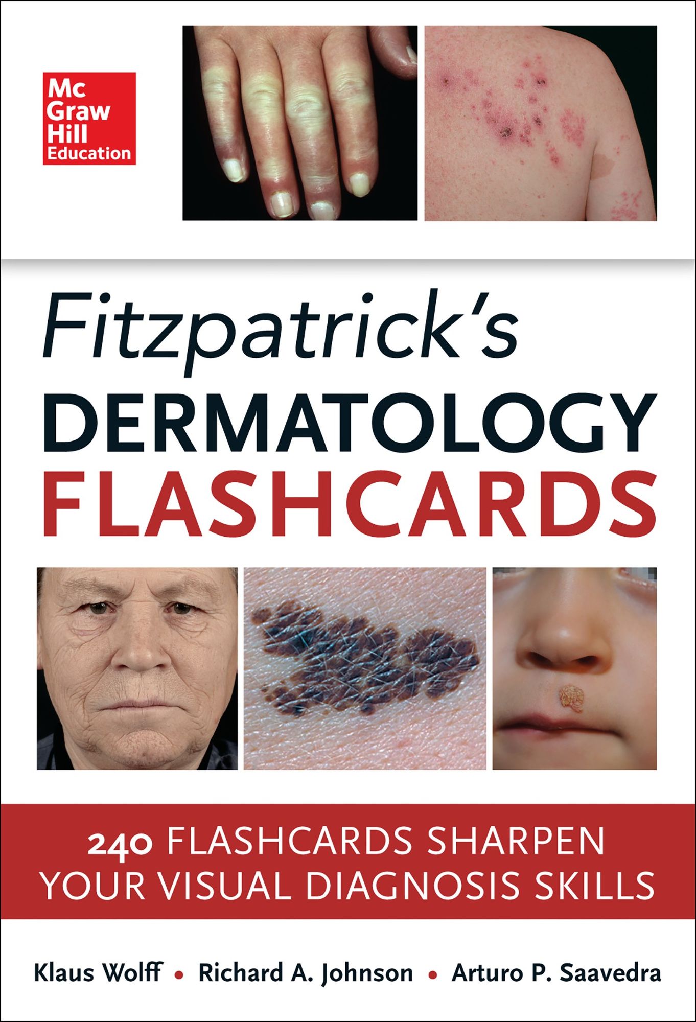 Fitzpatricks Dermatology Flash Cards