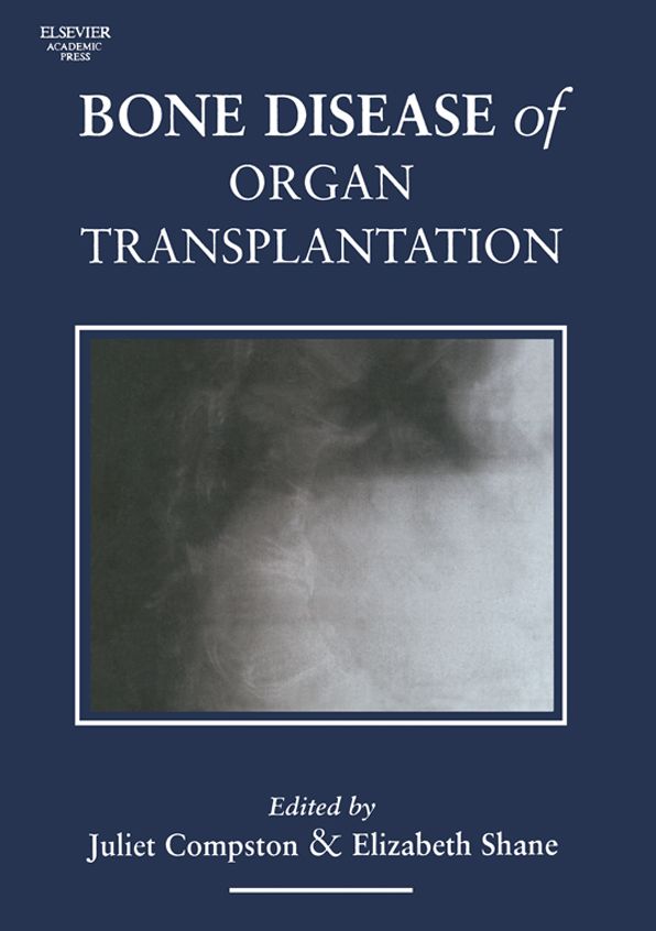 Bone Disease of Organ Transplantation