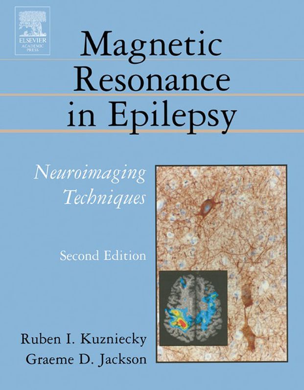 Magnetic Resonance in Epilepsy: Neuroimaging Techniques, Second Edition