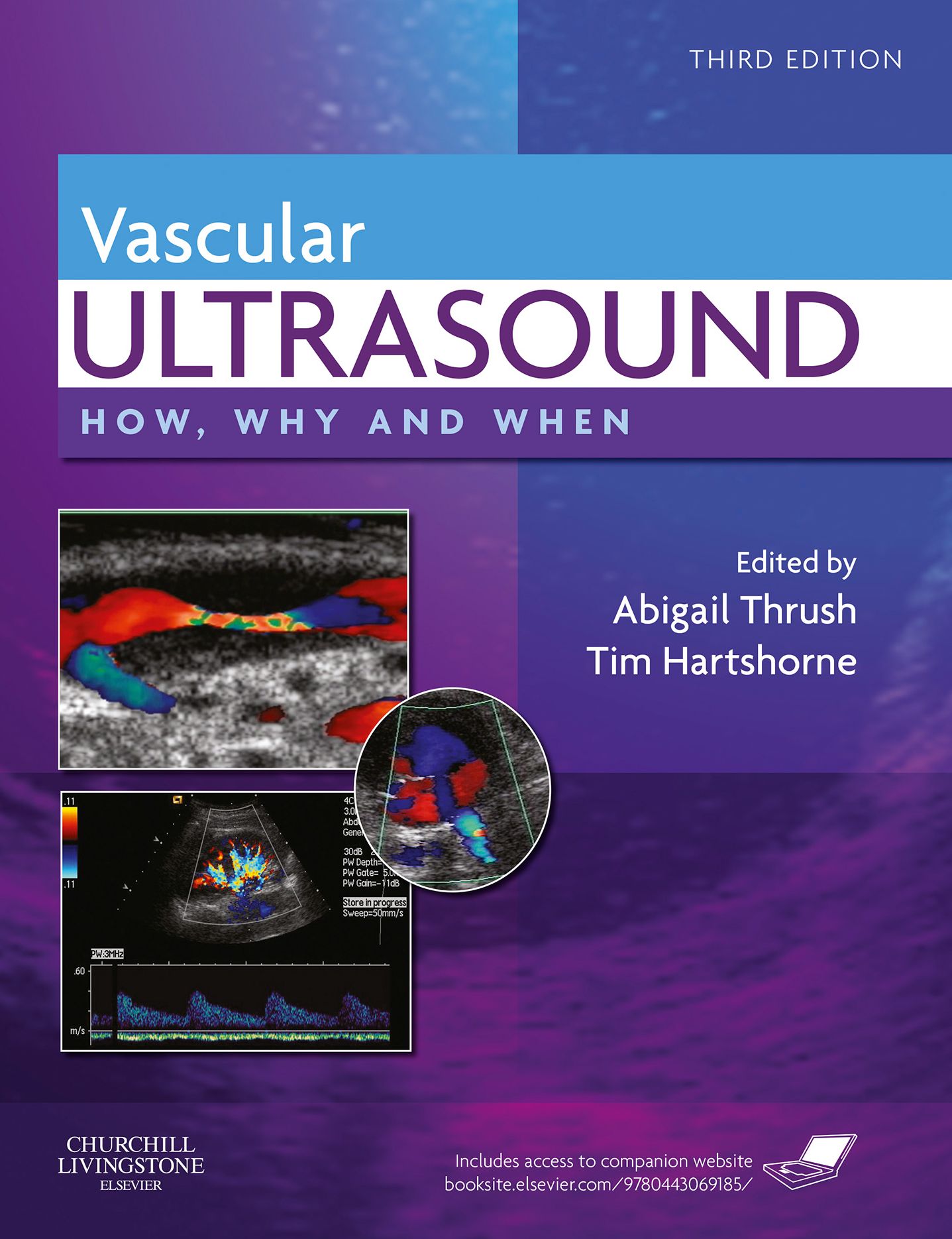 Vascular Ultrasound E-Book: How, Why and When