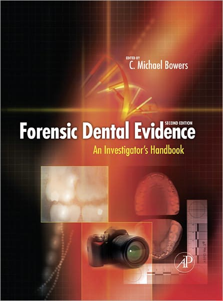 Forensic Dental Evidence: An Investigator's Handbook