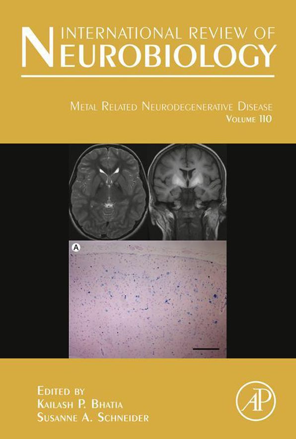 Metal Related Neurodegenerative Disease