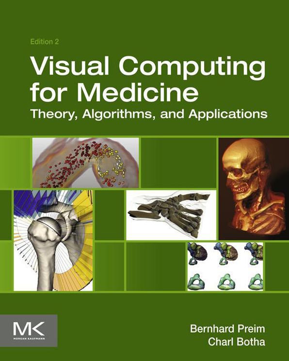 Visual Computing for Medicine: Theory, Algorithms, and Applications