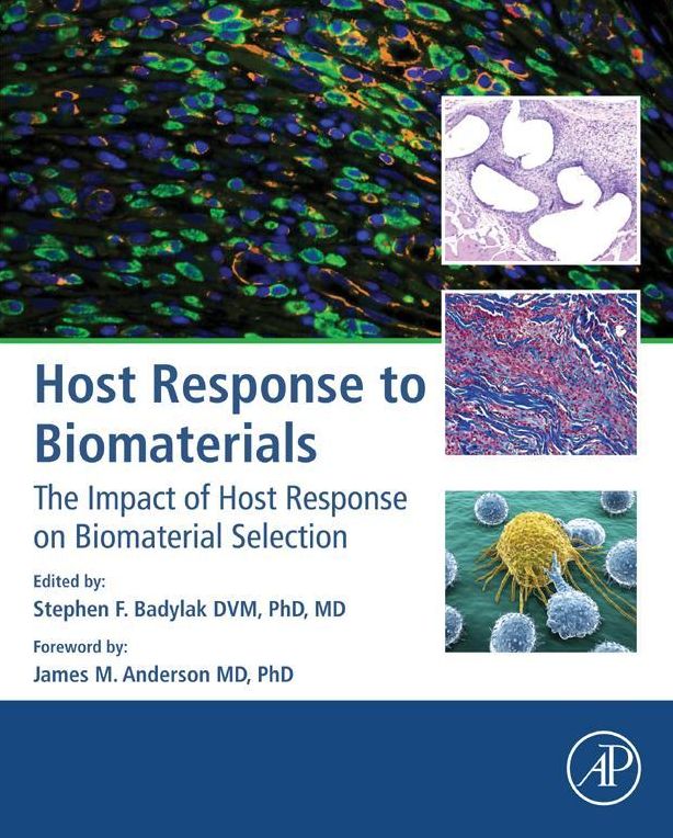 Host Response to Biomaterials: The Impact of Host Response on Biomaterial Selection