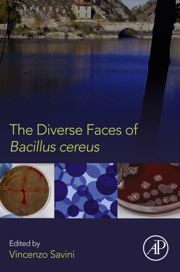 The Diverse Faces of Bacillus Cereus