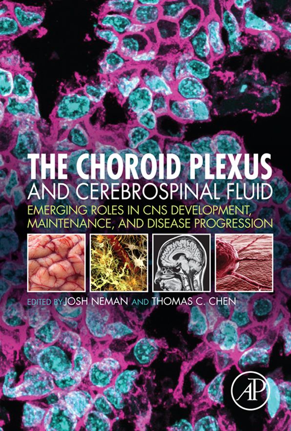 The Choroid Plexus and Cerebrospinal Fluid: Emerging Roles in CNS Development, Maintenance, and Disease Progression