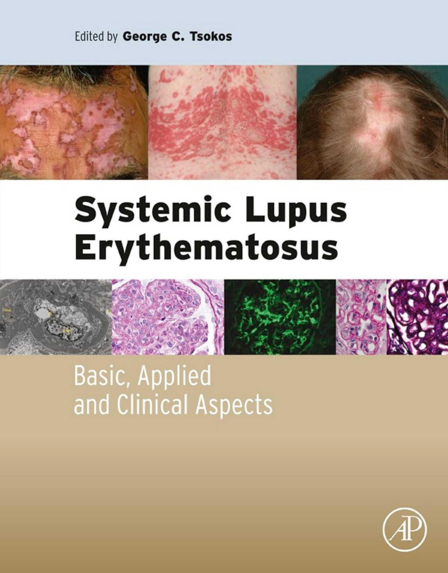 Systemic Lupus Erythematosus: Basic, Applied and Clinical Aspects