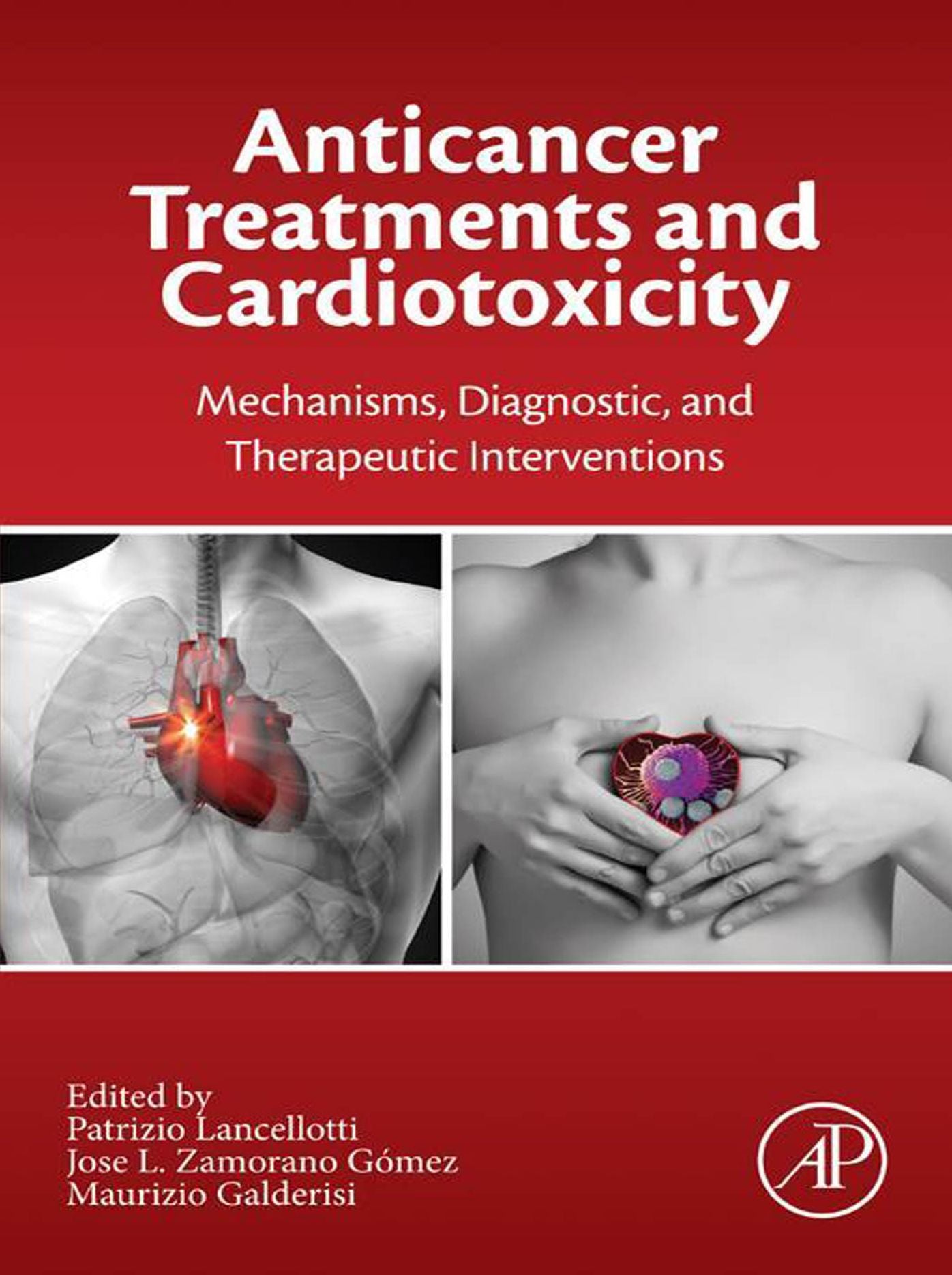 Anticancer Treatments and Cardiotoxicity: Mechanisms, Diagnostic and Therapeutic Interventions
