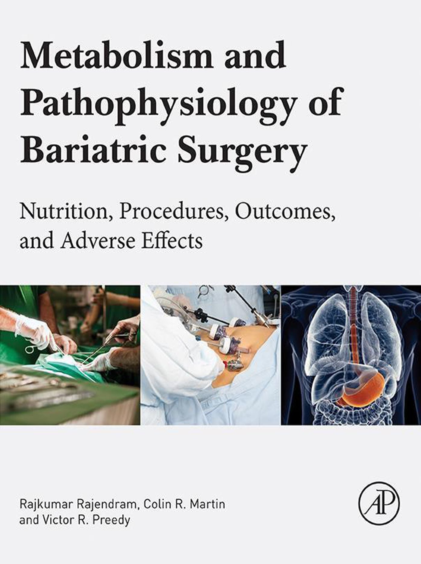 Metabolism and Pathophysiology of Bariatric Surgery: Nutrition, Procedures, Outcomes and Adverse Effects
