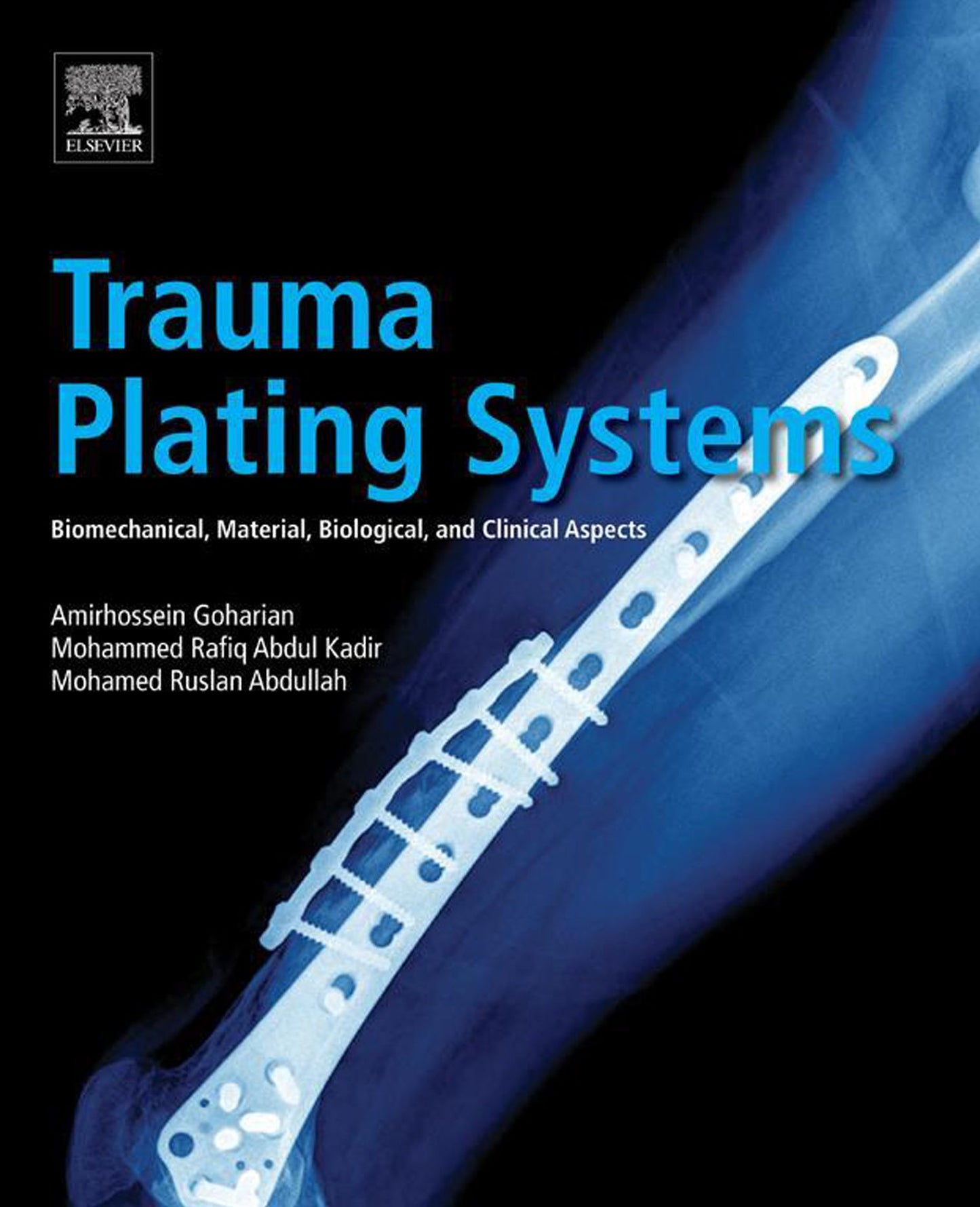 Trauma Plating Systems: Biomechanical, Material, Biological, and Clinical Aspects