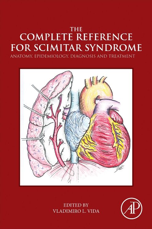 The Complete Reference for Scimitar Syndrome: Anatomy, Epidemiology, Diagnosis and Treatment