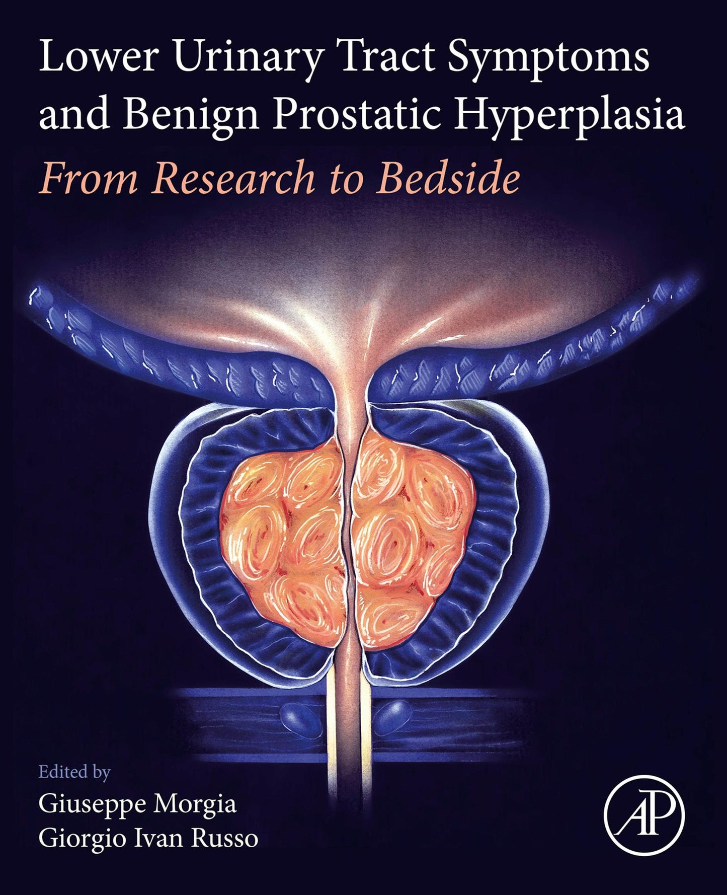 Lower Urinary Tract Symptoms and Benign Prostatic Hyperplasia: From Research to Bedside