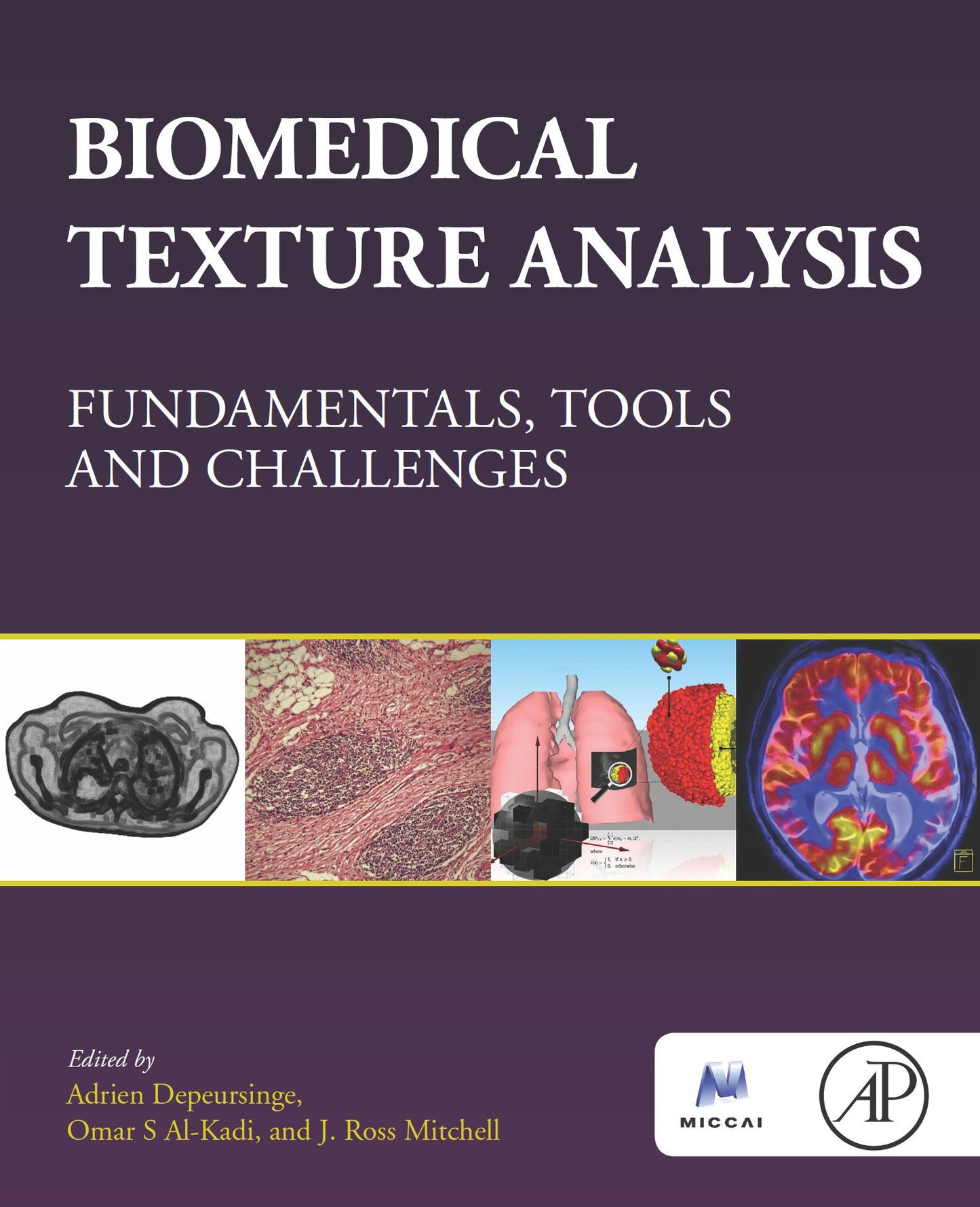 Biomedical Texture Analysis: Fundamentals, Tools and Challenges