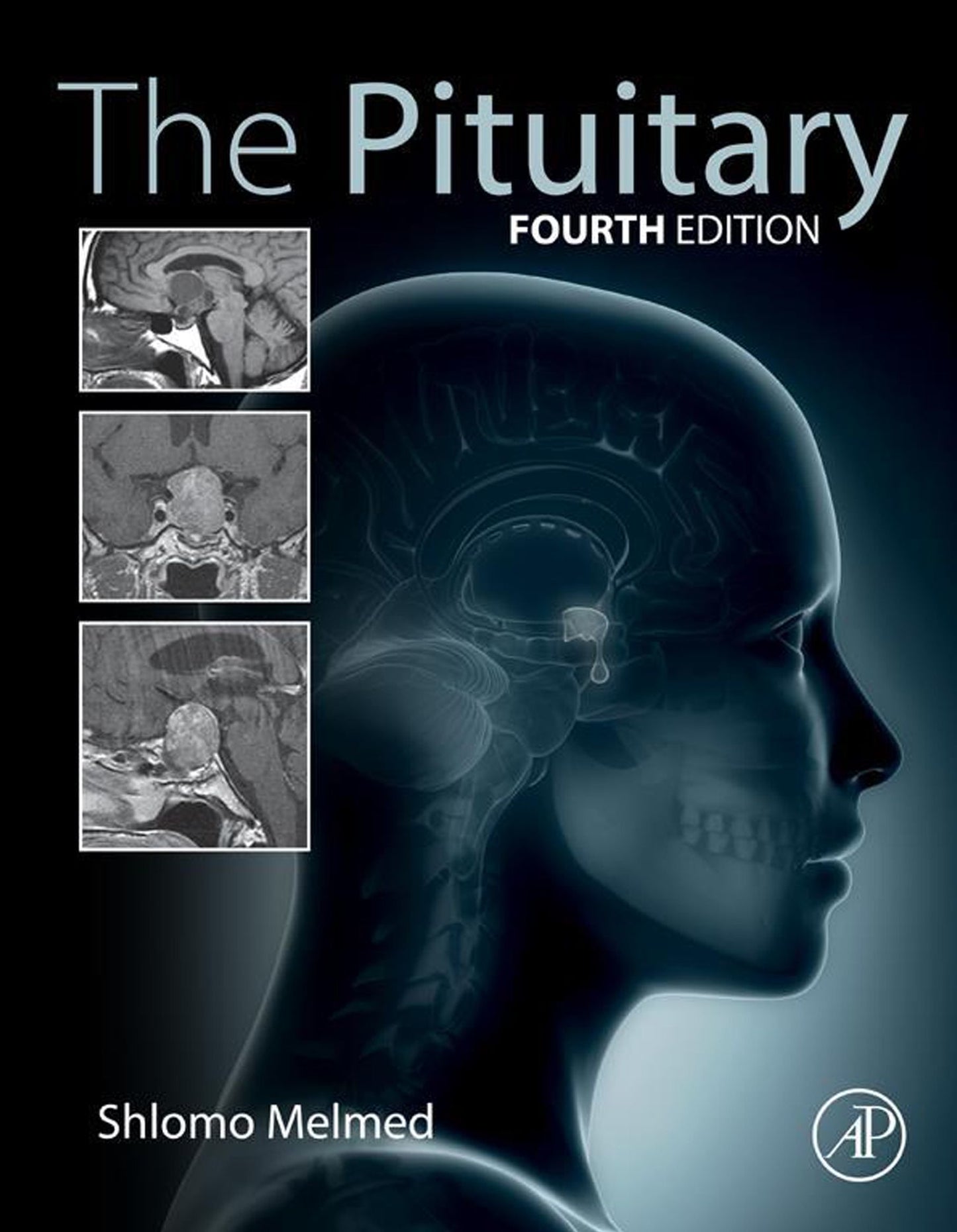 The Pituitary