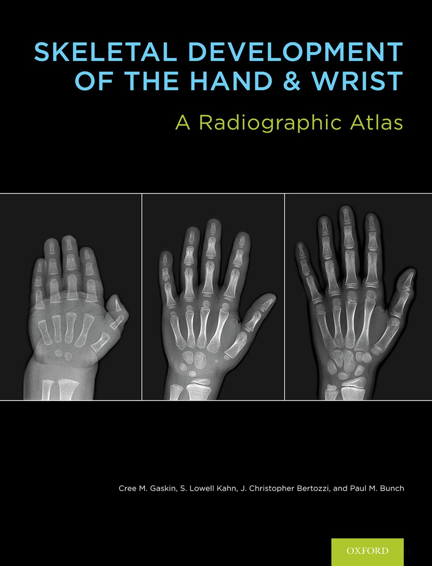 Skeletal Development of the Hand and Wrist: A Radiographic Atlas and Digital Bone Age Companion