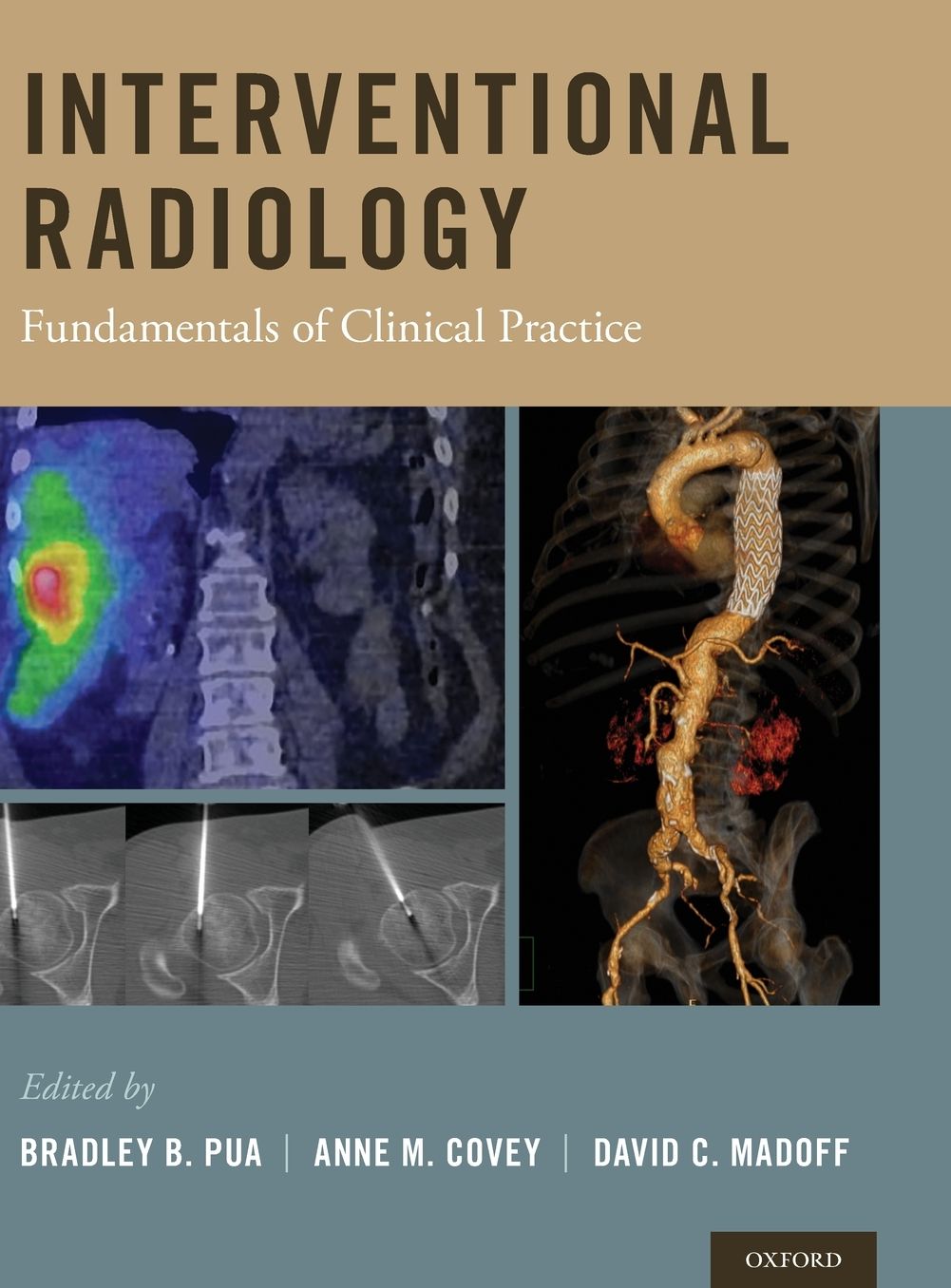 Interventional Radiology: Fundamentals of Clinical Practice