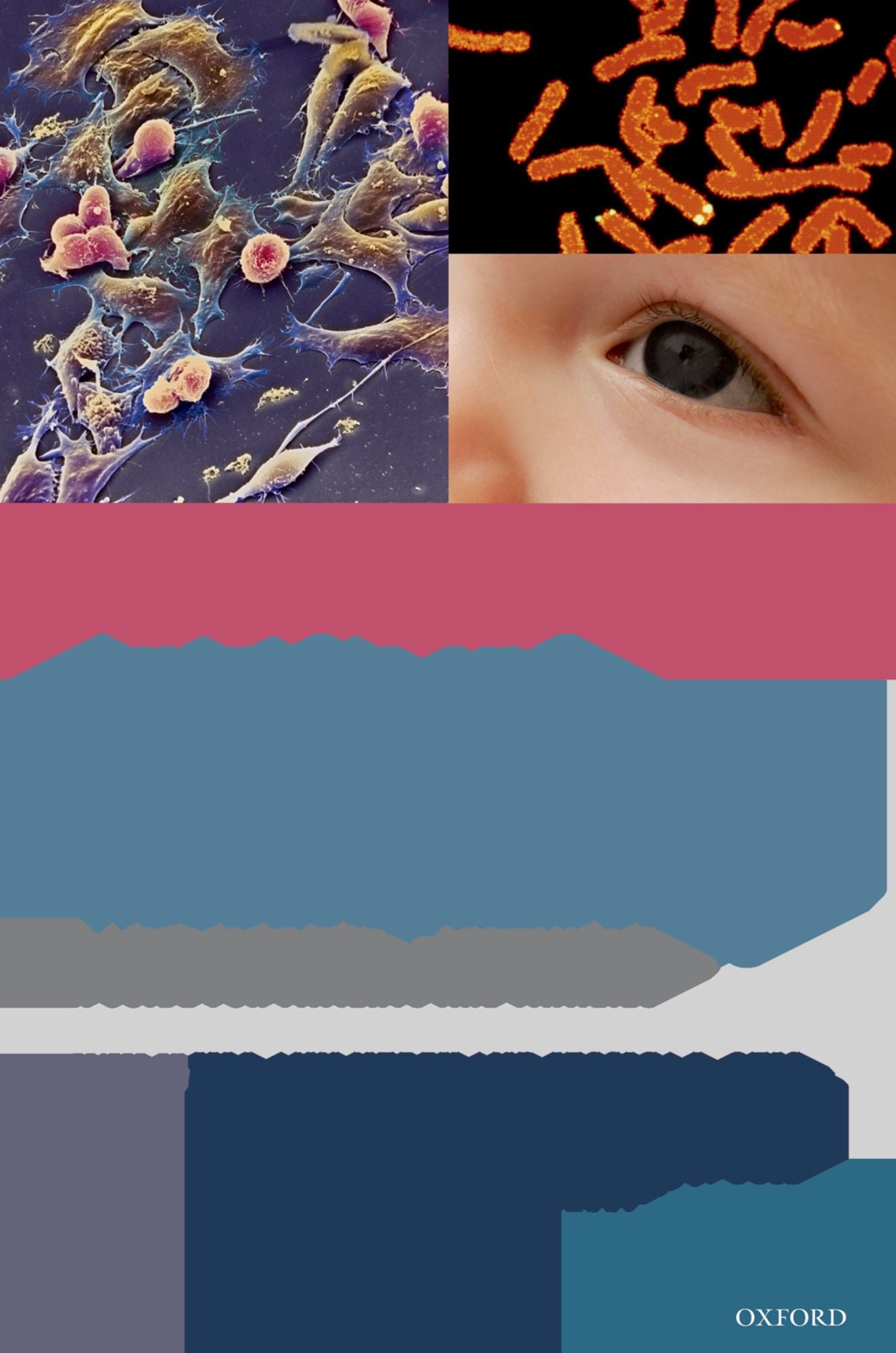 Aniridia and WAGR Syndrome: A Guide for Patients and Their Families