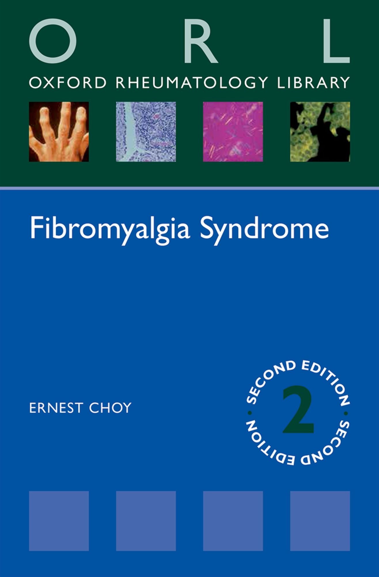 Fibromyalgia Syndrome