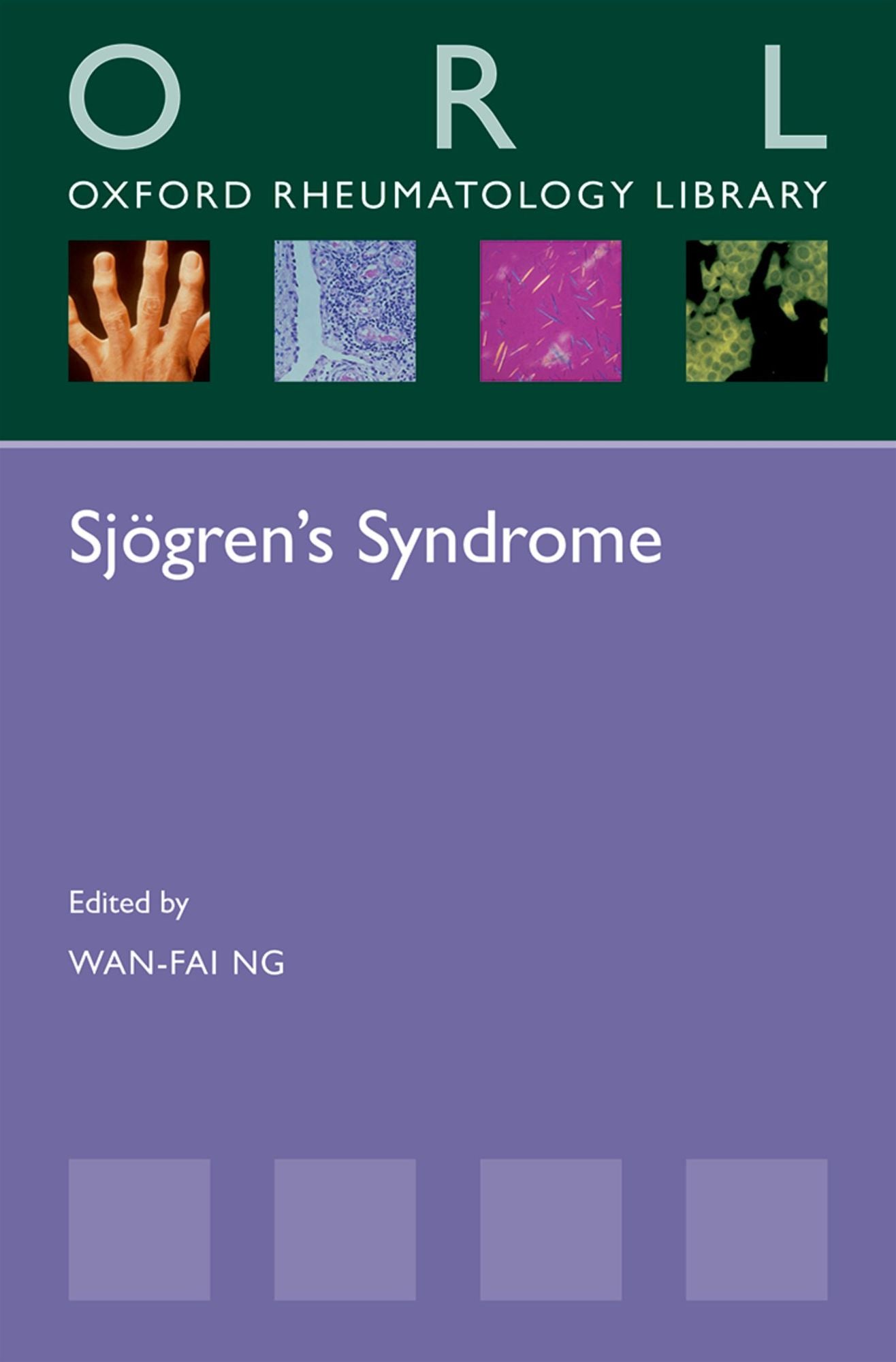 Sj#x000F6;gren's Syndrome