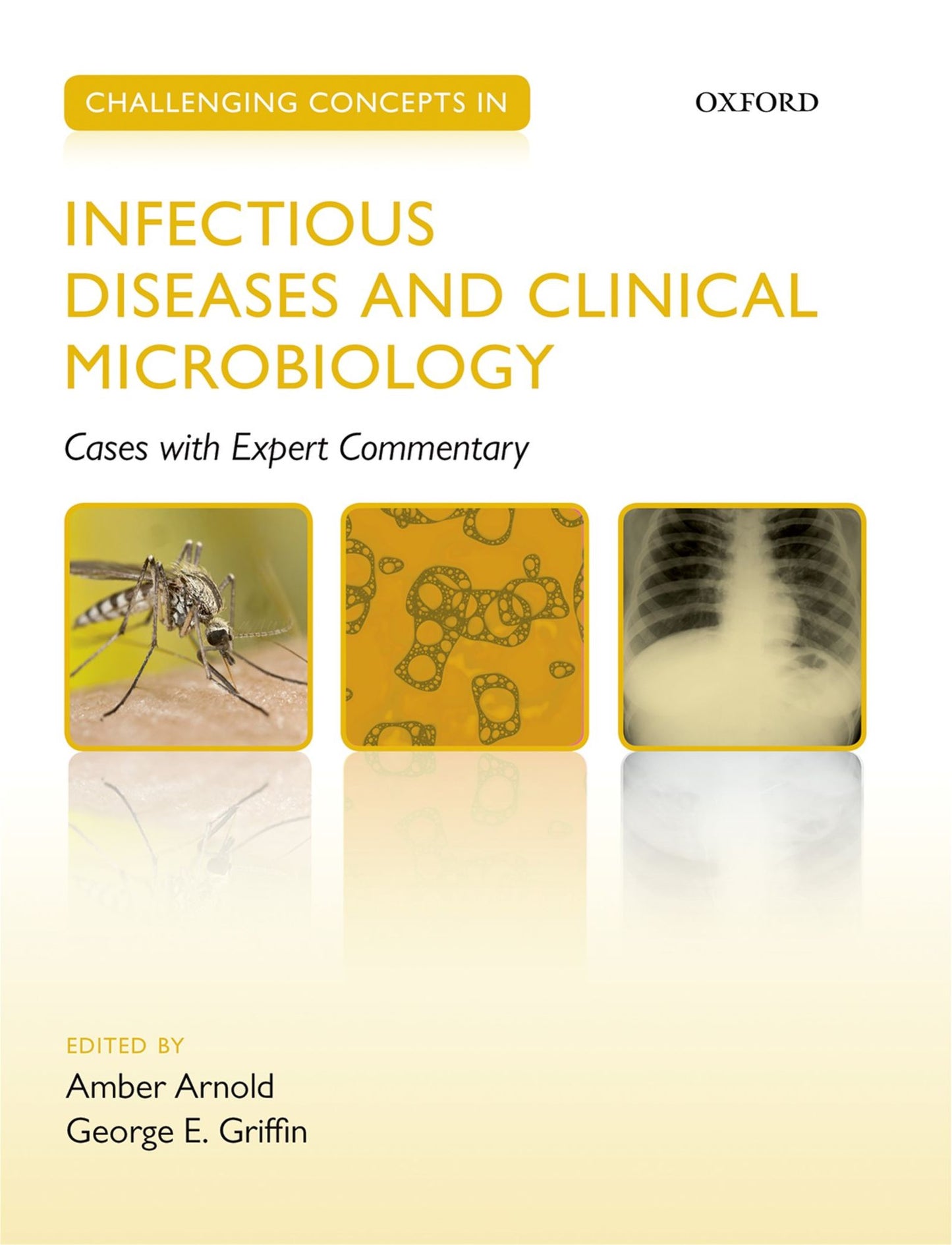Challenging Concepts in Infectious Diseases and Clinical Microbiology: Cases with Expert Commentary
