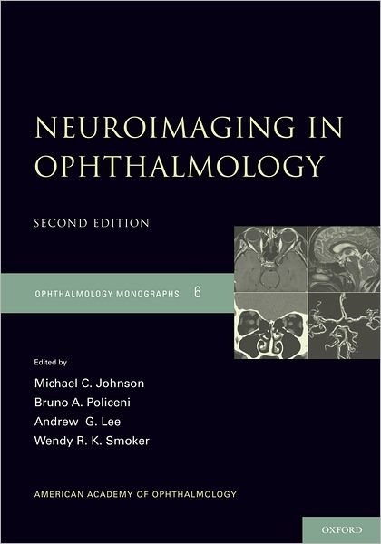 Neuroimaging in Ophthalmology
