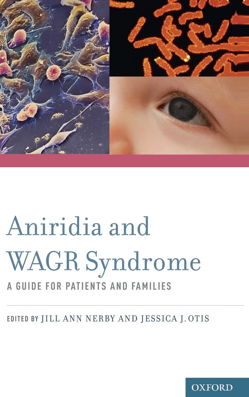Aniridia and WAGR Syndrome: A Guide for Patients and Their Families