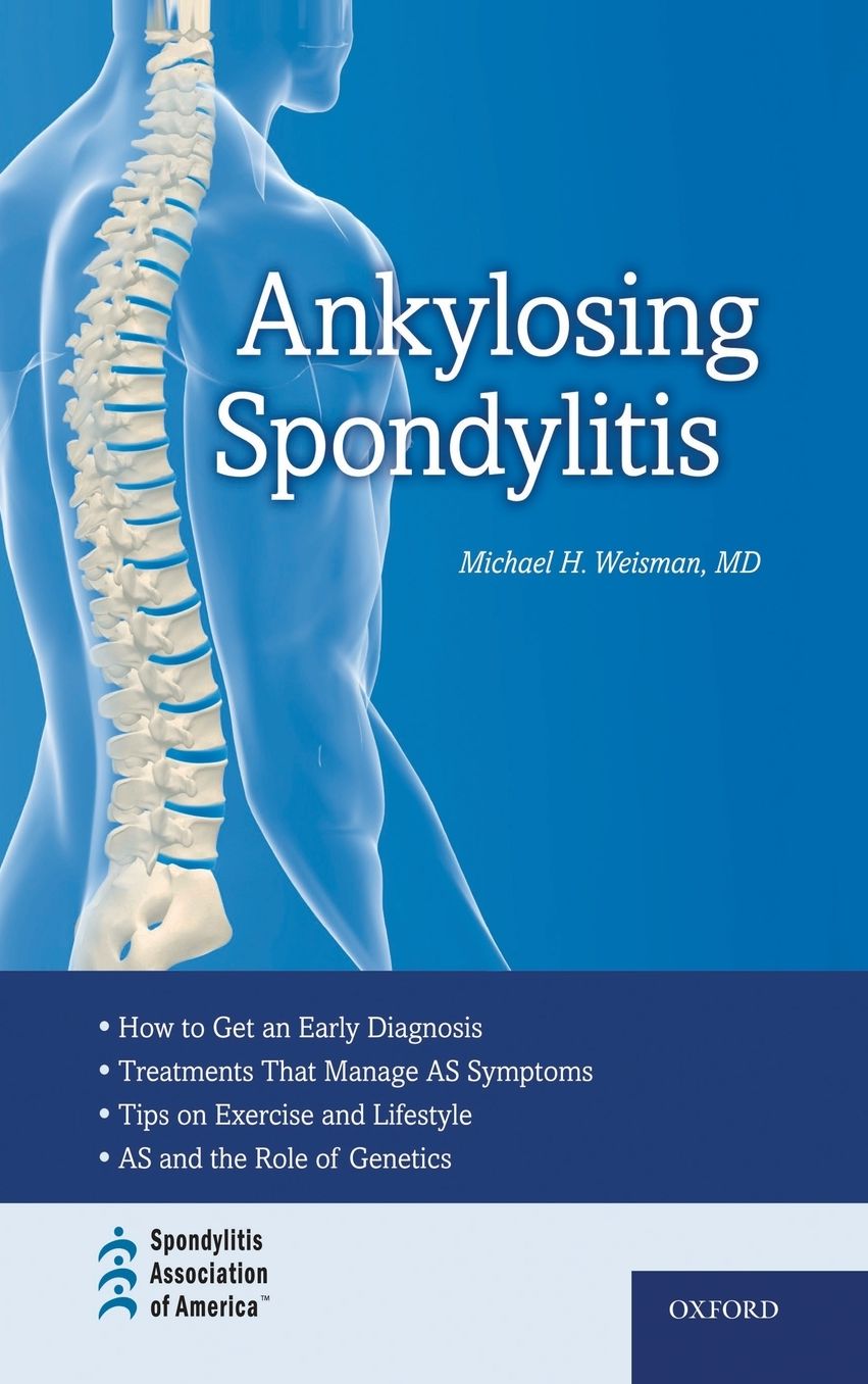 Ankylosing Spondylitis