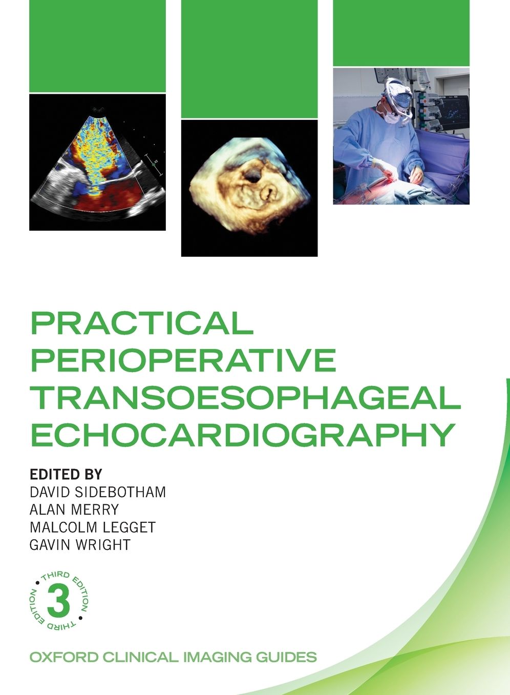 Practical Perioperative Transoesophageal Echocardiography