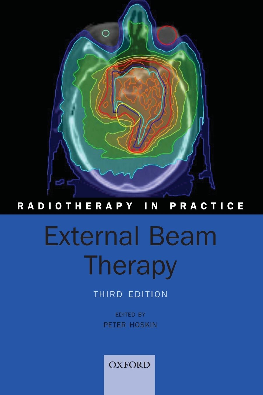 External Beam Therapy