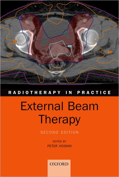 External Beam Therapy