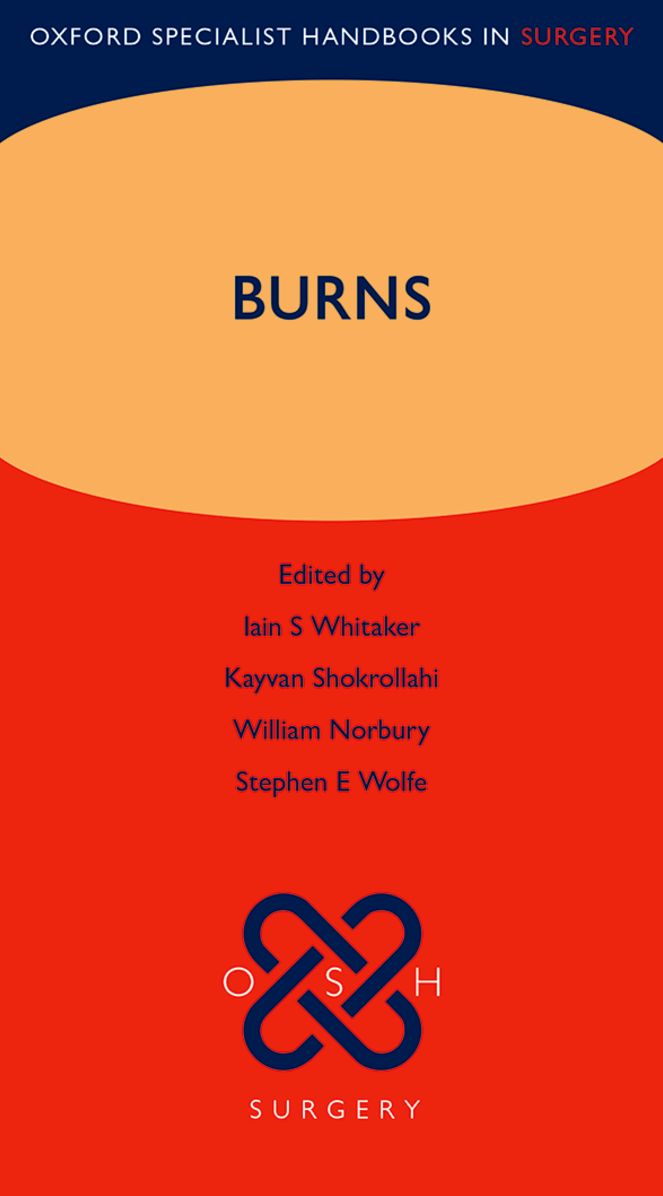 Burns