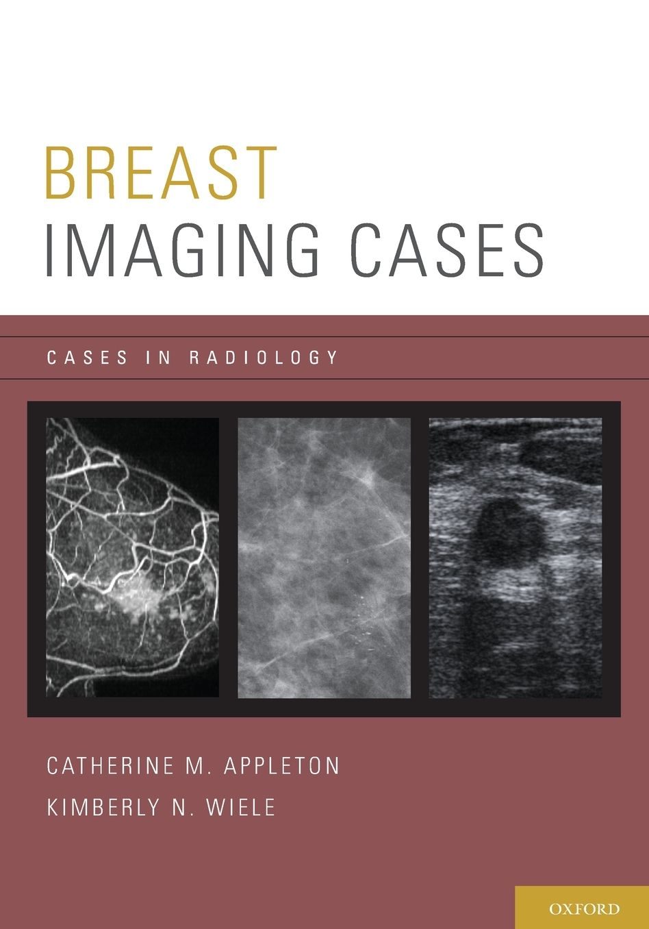 Breast Imaging Cases