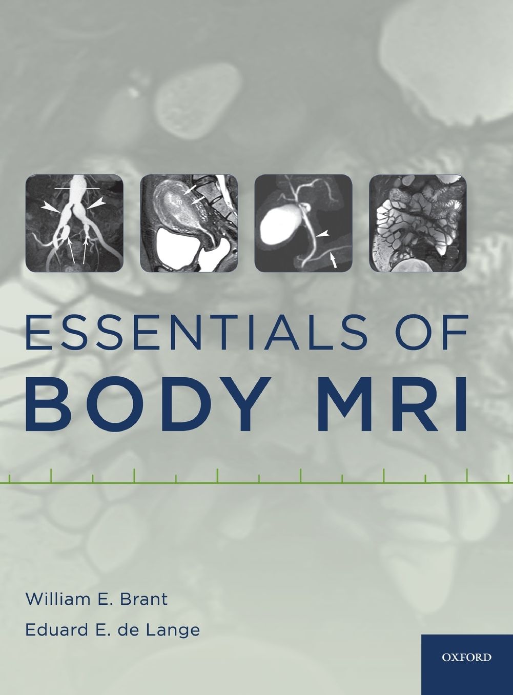 Essentials of Body MRI