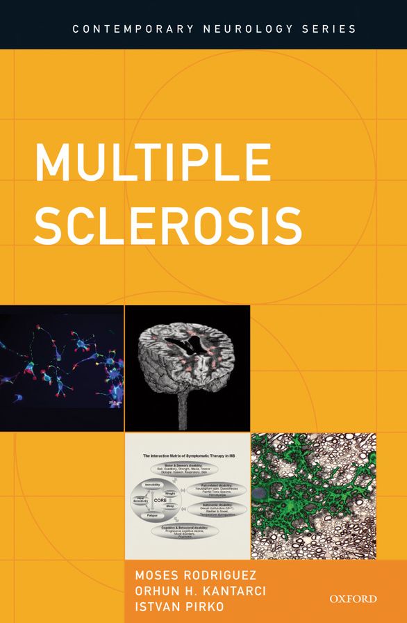 Multiple Sclerosis