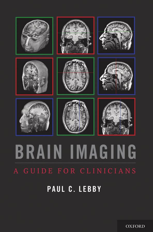 Brain Imaging: A Guide for Clinicians