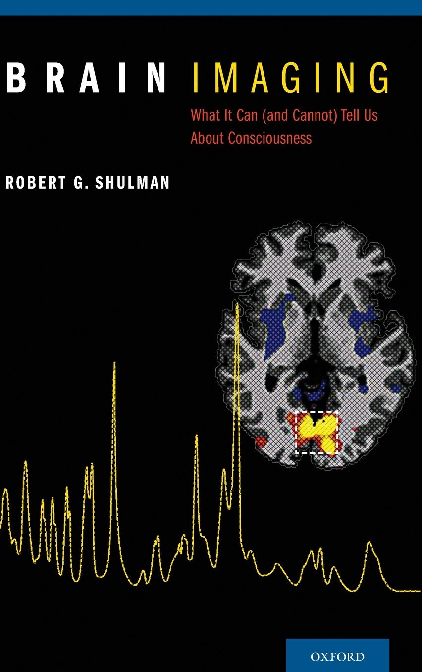 Brain Imaging: What it Can (and Cannot) Tell Us About Consciousness
