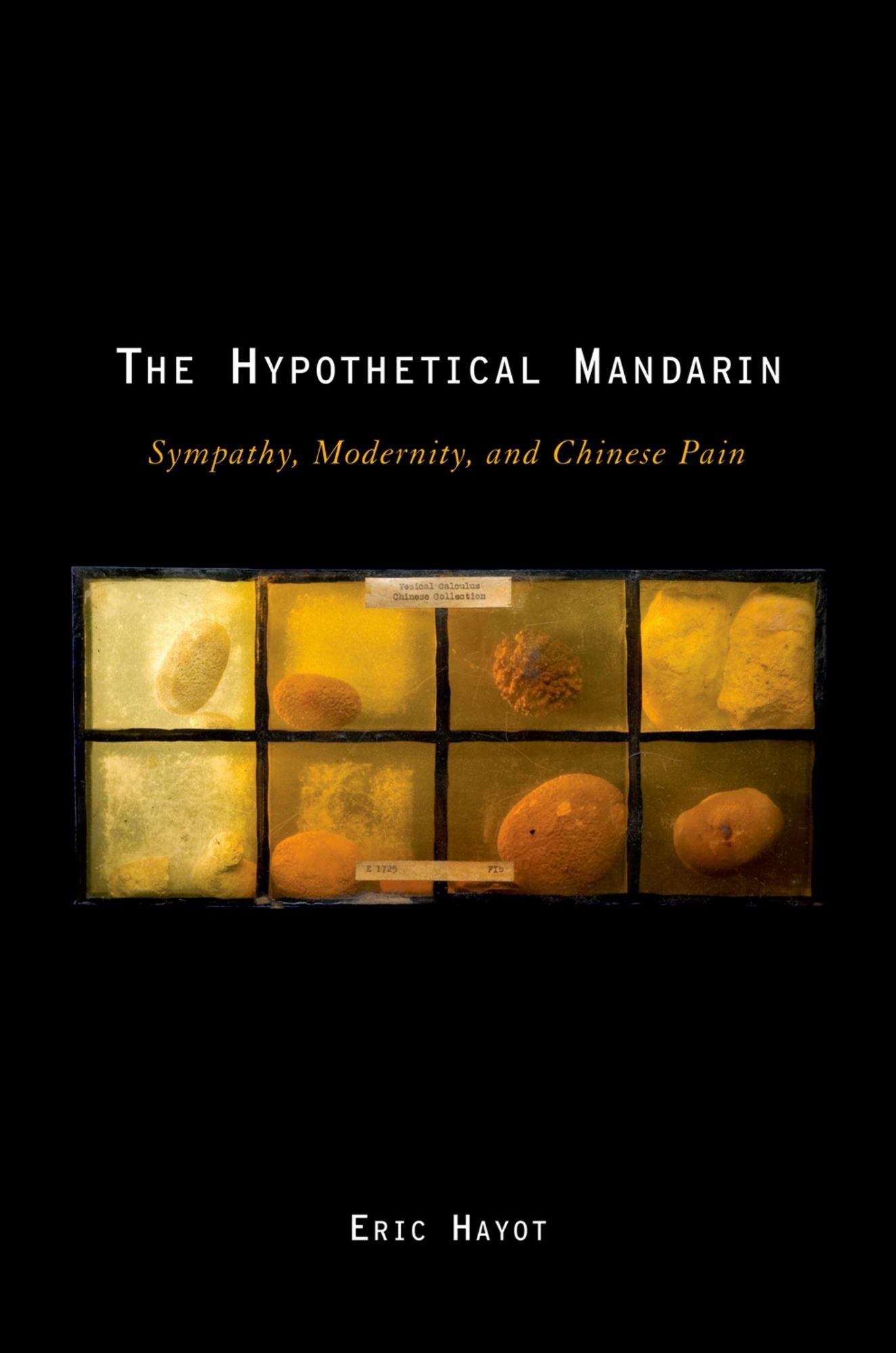 The Hypothetical Mandarin: Sympathy, Modernity, and Chinese Pain