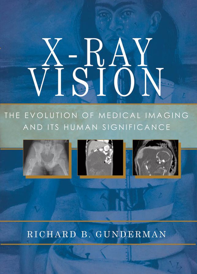 X-Ray Vision: The Evolution of Medical Imaging and Its Human Implications