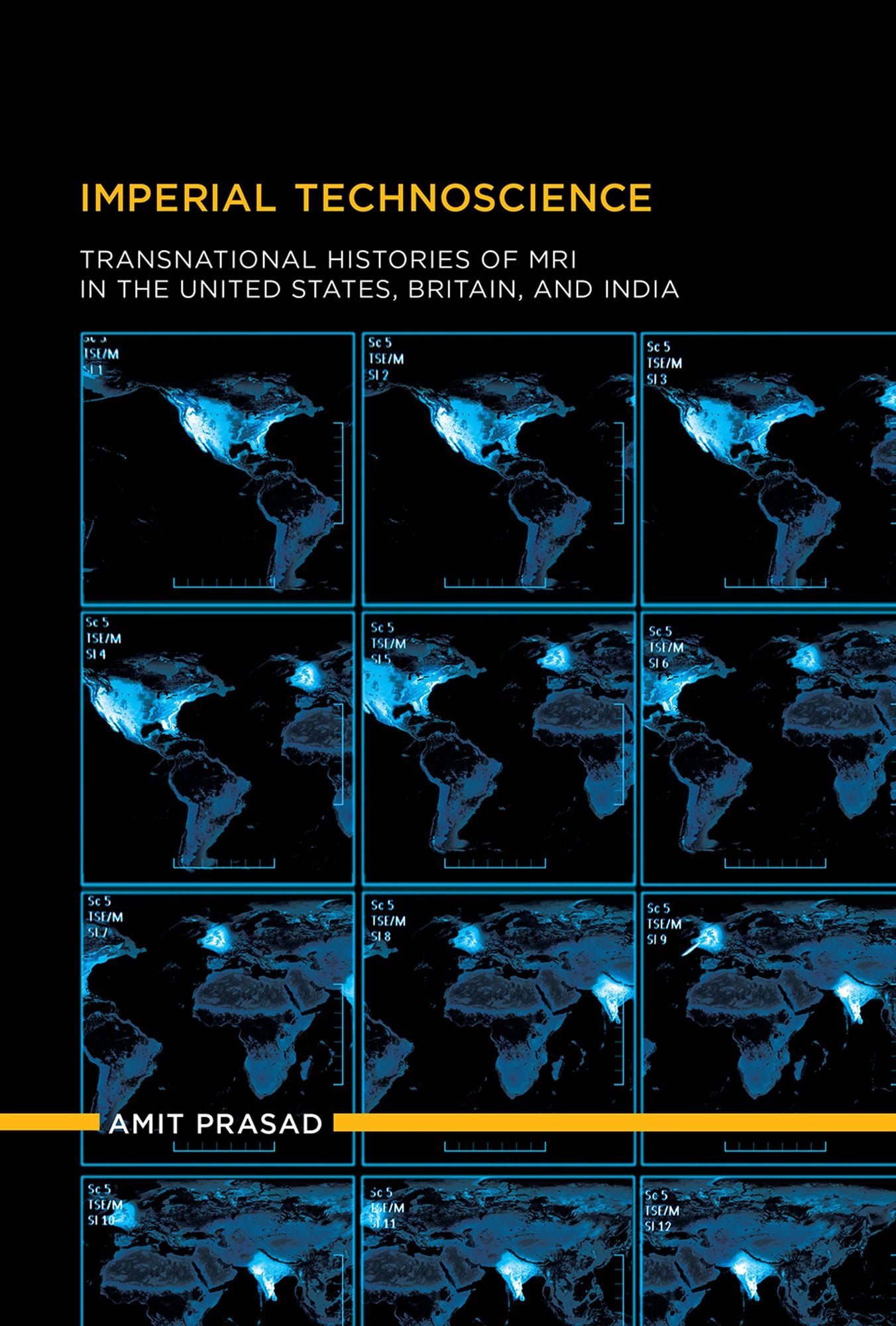 Imperial Technoscience: Transnational Histories of MRI in the United States, Britain, and India