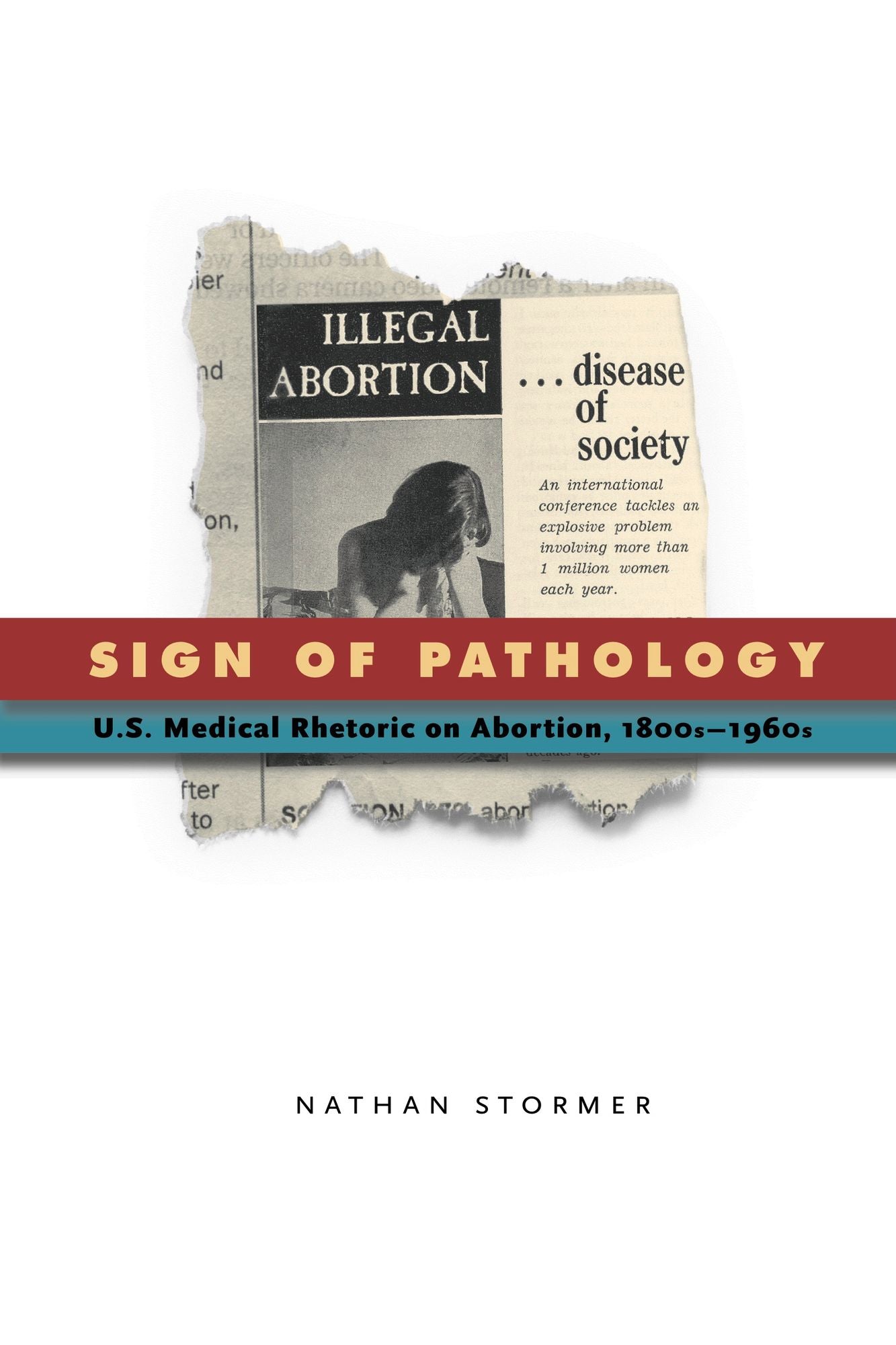 Sign of Pathology: U.S. Medical Rhetoric on Abortion, 1800s-1960s